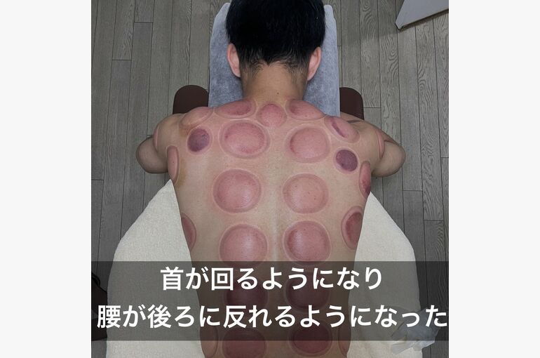 画像 527 18