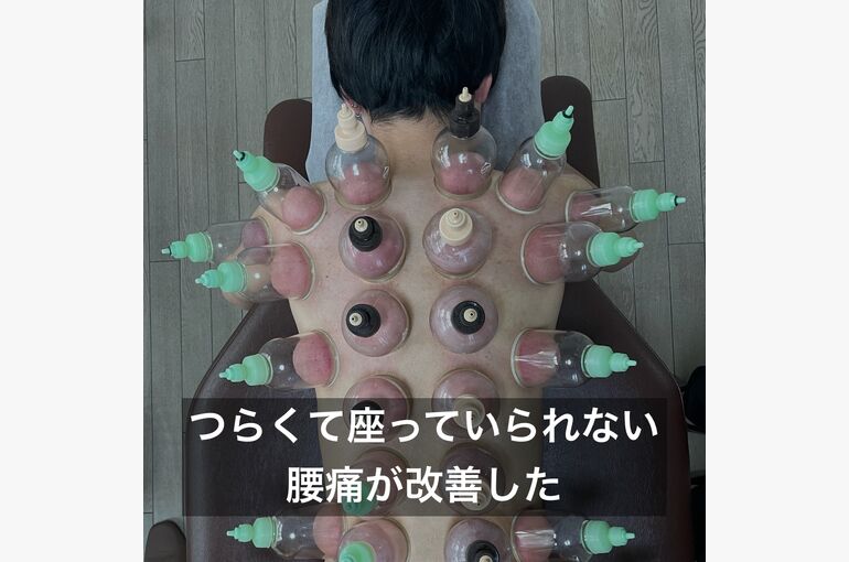 画像 527 20