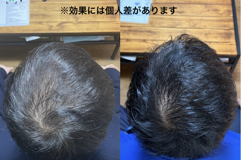 画像 153