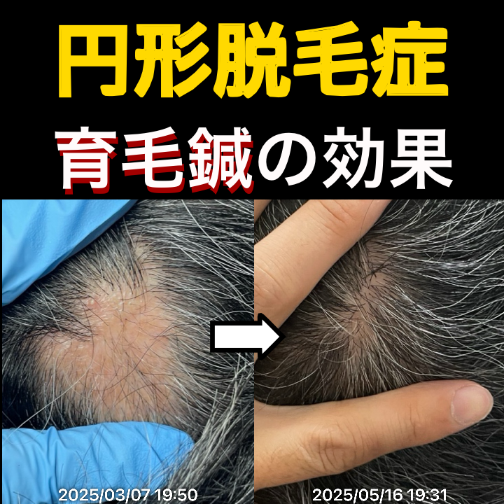 画像 82